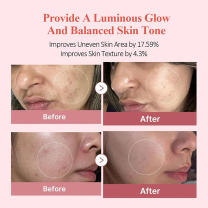 A refreshing facial toner enriched with Salmon PDRN, collagen, and pink peptides that deeply hydrates, brightens skin, and helps reduce signs of aging—leaving your skin smooth, plump, and glowing.